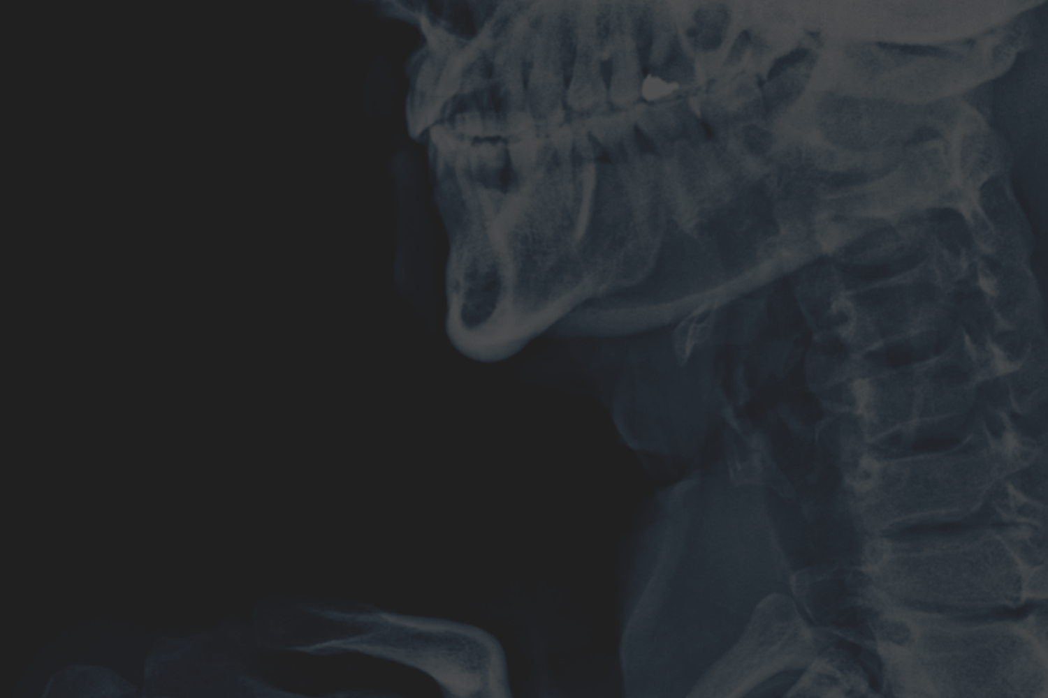 x-ray of a skeleton