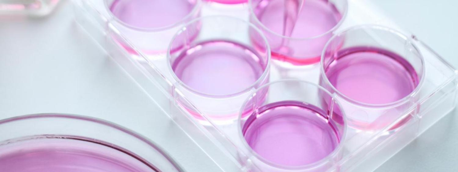 Chemistry University of Colorado Denver