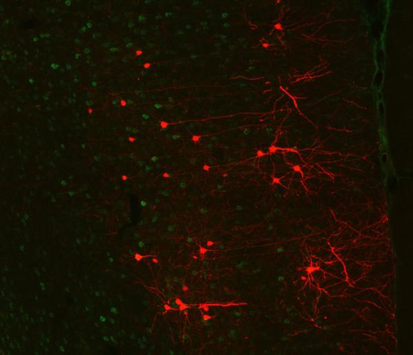 mCherry fluorescence