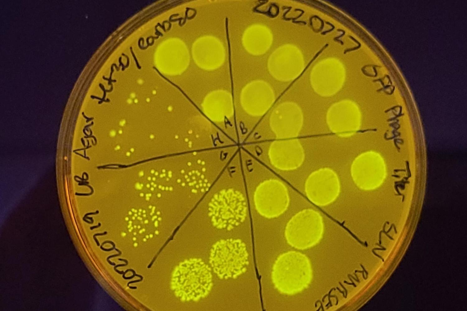 Fluorescent E coli cells expressing GFP