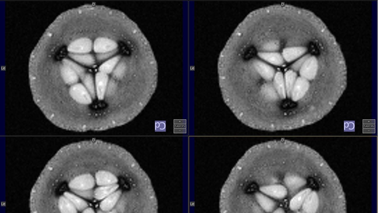 diagnostic imaging of cucumbers