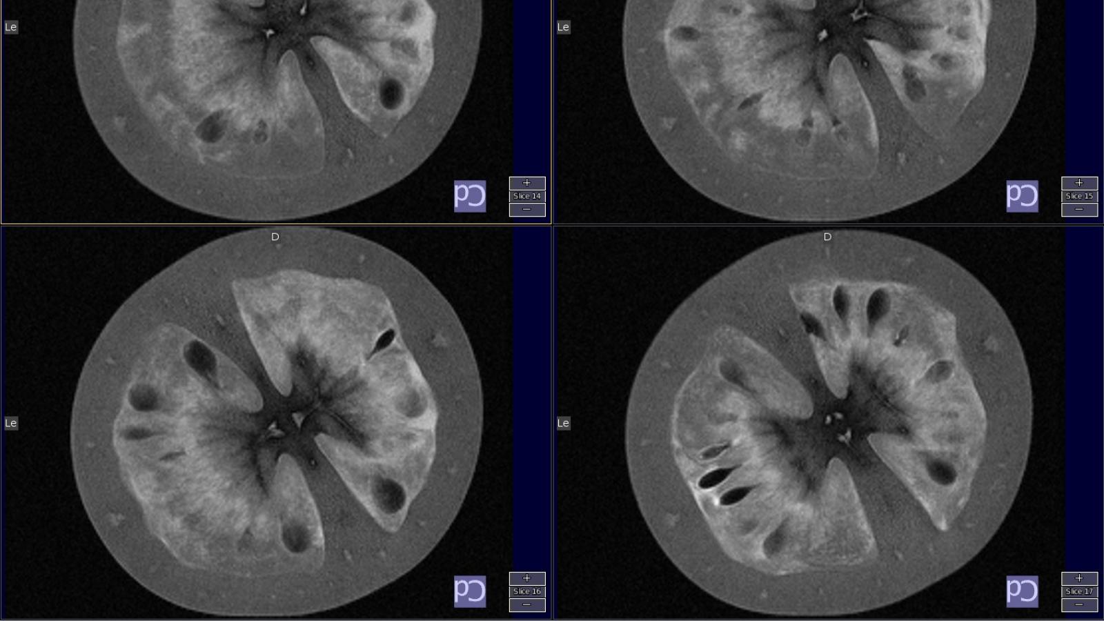 tomato imaging