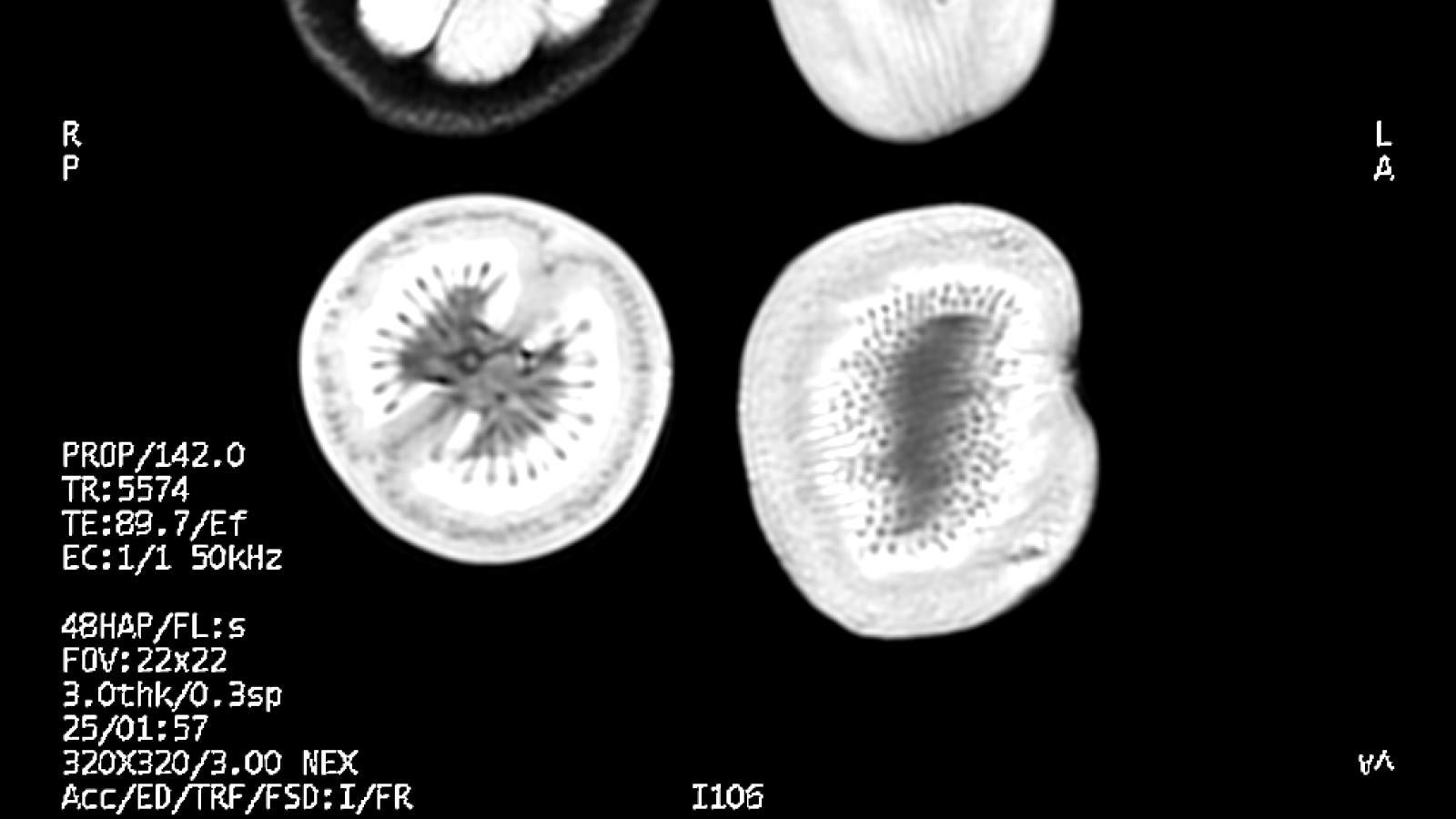 T2 mri of various fruits